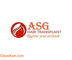 Hair Transplant Cost in India