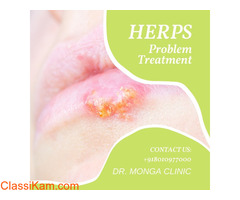Best Herpes Simplex Virus Treatment - Dr Monga