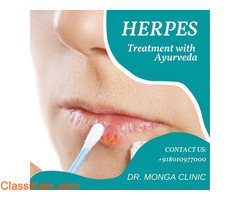 Fastest Way to Cure Herpes - Dr Monga