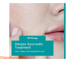 Effective Remedies For Herpes in Ambala- Dr Monga
