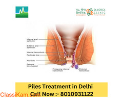 Best treatment for piles in Delhi  +91-8010931122