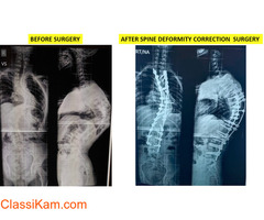 Spine Surgeon in Delhi / Spine Specialist in Delhi