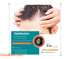 Hair Patch for Men in Delhi