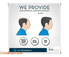 Best Hair Patches in Delhi