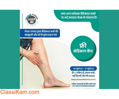 Advanced Varicose Vein Laser Surgery at Laser 360 Clinic (New Delhi)