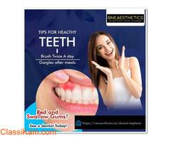 Crowns & Bridges Treatment in Gurgaon | Oneaesthetics