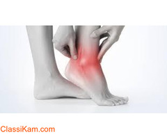 Leg pain: Causes & Treatment: Lifecarepills