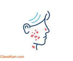 Best Skin Cancer Treatment Hospitals in Bangalore