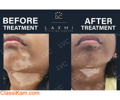 Best Doctor & Best Homeopathic Vitiligo Treatment and Packs.